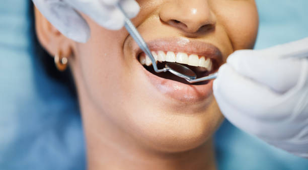 Best Emergency Dental Care for Broken or Chipped Teeth in Barboursville, WV