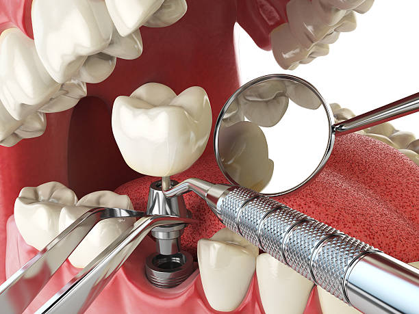 Best Cosmetic Emergency Dentistry in Barboursville, WV